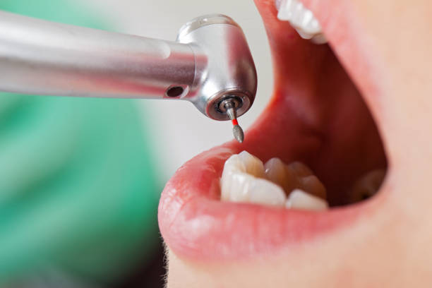 Best Broken or Cracked Tooth Emergency Dentist in Clarkesville, GA